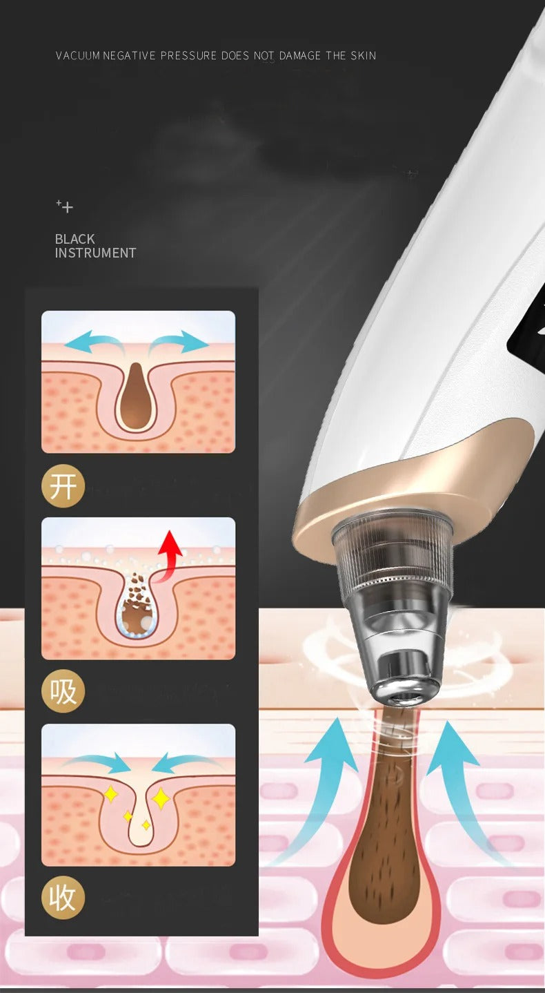 Upgraded Blackhead Remover Vacuum Facial Pore Cleaner Electric Acne Comedone Whitehead Extractor Tool 5 Probes For Women And Men