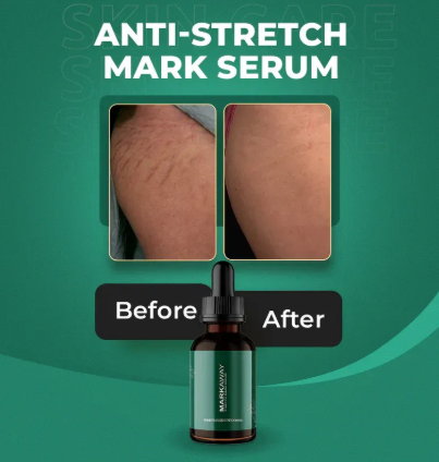 Markaway Stretch Mark Serum – Herbal Formula For Hydration, Toning & Dark Spot Correction (30ml)