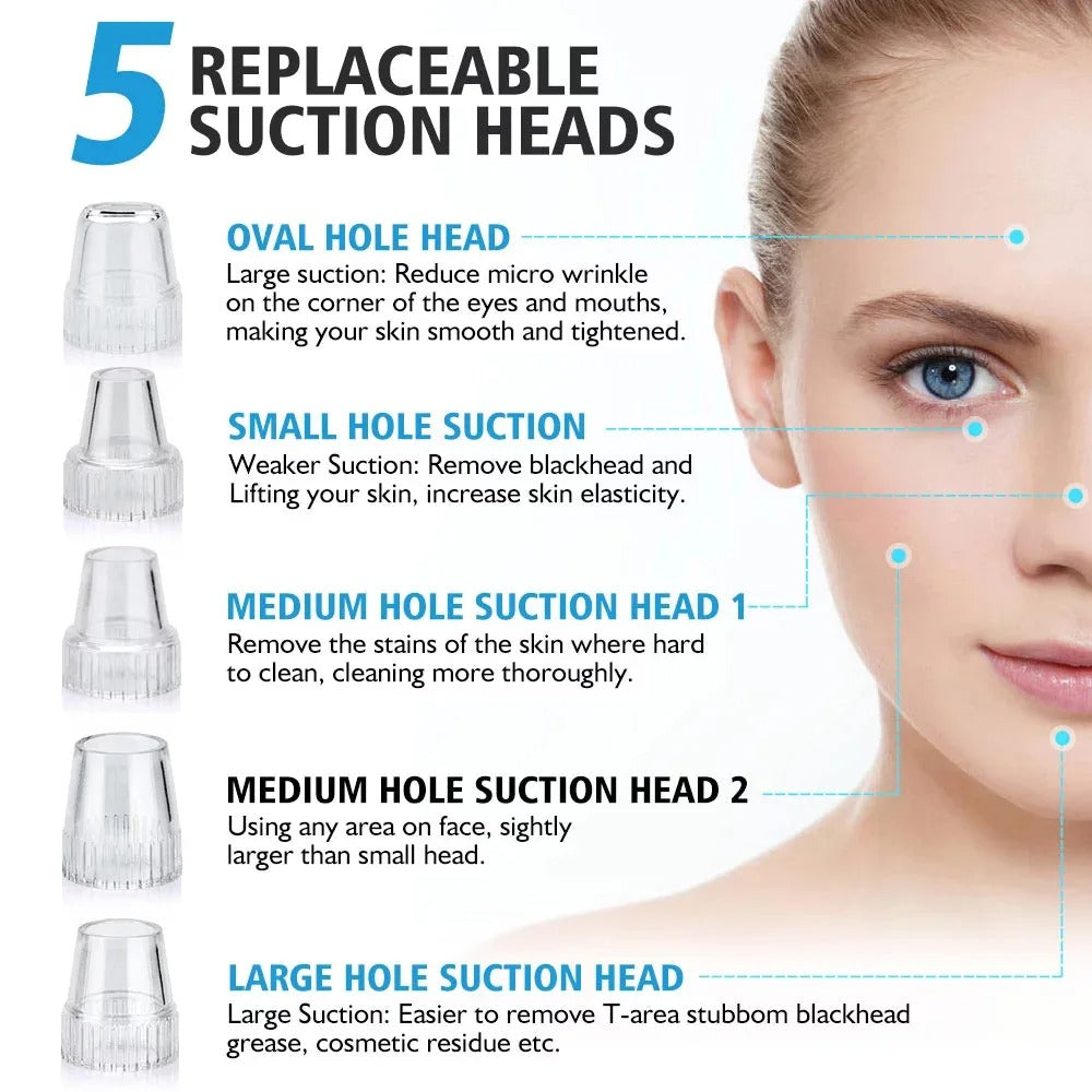 Upgraded Blackhead Remover Vacuum Facial Pore Cleaner Electric Acne Comedone Whitehead Extractor Tool 5 Probes For Women And Men
