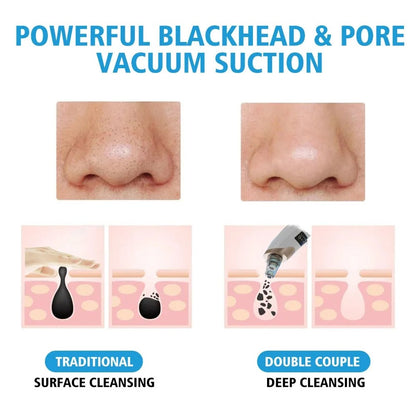 Upgraded Blackhead Remover Vacuum Facial Pore Cleaner Electric Acne Comedone Whitehead Extractor Tool 5 Probes For Women And Men