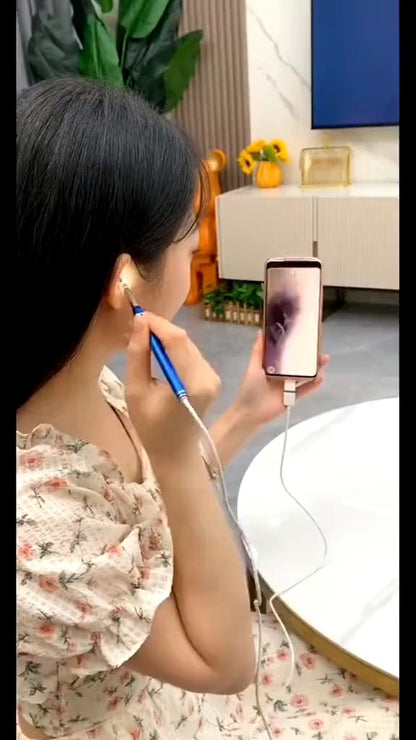 SmartScan Wireless Ear Cleaner with Camera Wireless Otoscope 1080P HD